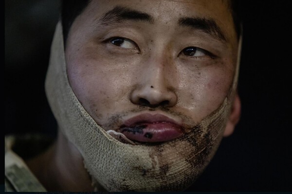 우크라이나군에 생포된 북한군. /사진=연합뉴스